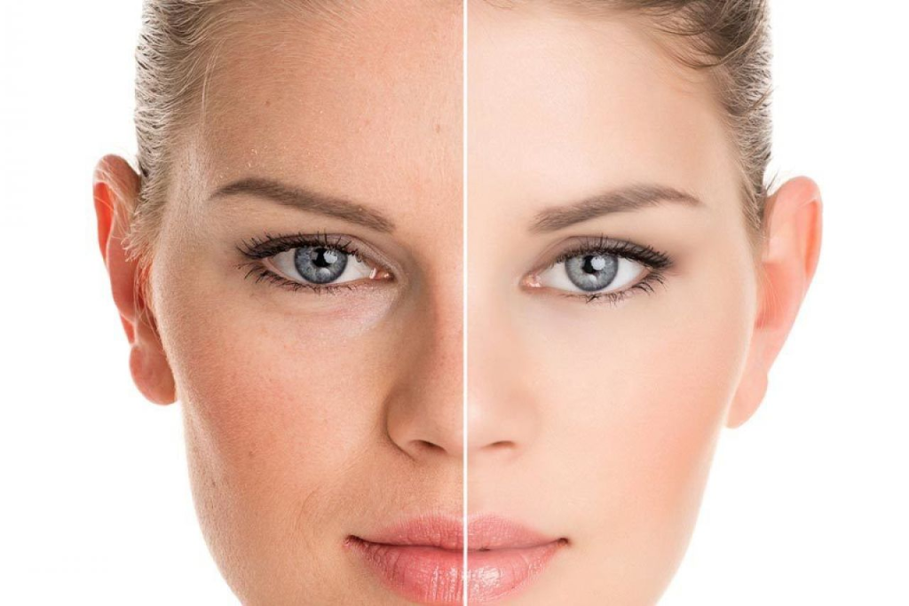 A imagem apresenta uma comparação entre dois lados de um rosto de uma mulher. O lado esquerdo mostra o rosto sem maquiagem, com características naturais da pele, como pequenas manchas e imperfeições. Já o lado direito está com maquiagem, evidenciando uma pele uniforme, iluminada e sem marcas visíveis. A linha que divide as duas partes do rosto é clara, destacando a diferença entre os dois aspectos. O foco está nos olhos da mulher, que têm uma expressão suave e destacada em ambos os lados.